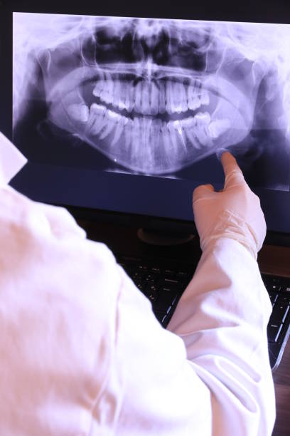Best Emergency Wisdom Teeth Removal in Oklahoma, PA