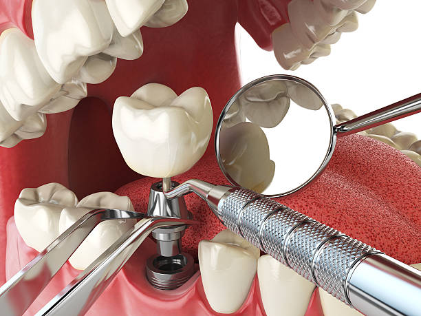Best Emergency Broken Tooth Repair in Oklahoma, PA
